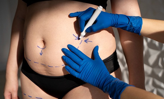 Fat Loss Injections How it is done