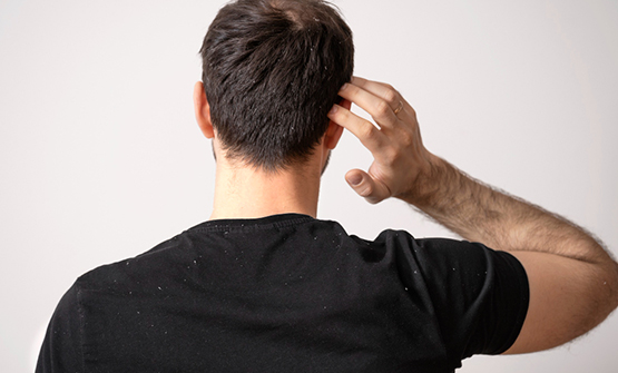 Hair Botulinum Toxin Who can do it