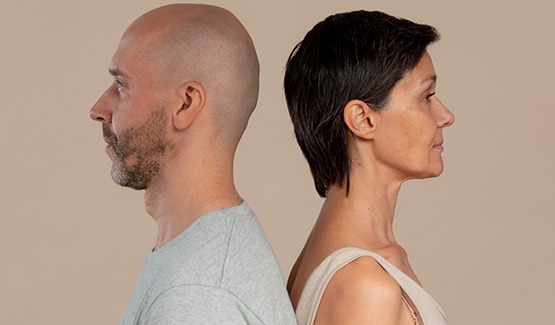 Hair Mesotherapy 3 Hair Mesotherapy Who can do it