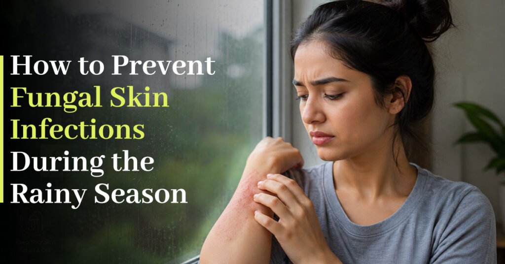 How to Prevent Fungal Skin Infections During the Rainy Season 1 How to Prevent Fungal Skin Infections During the Rainy Season 1 1 1