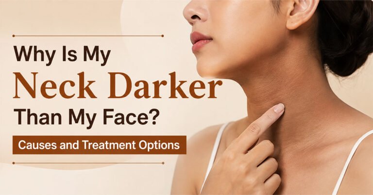 Why Is My Neck Darker Than My Face? Causes and Treatment Options